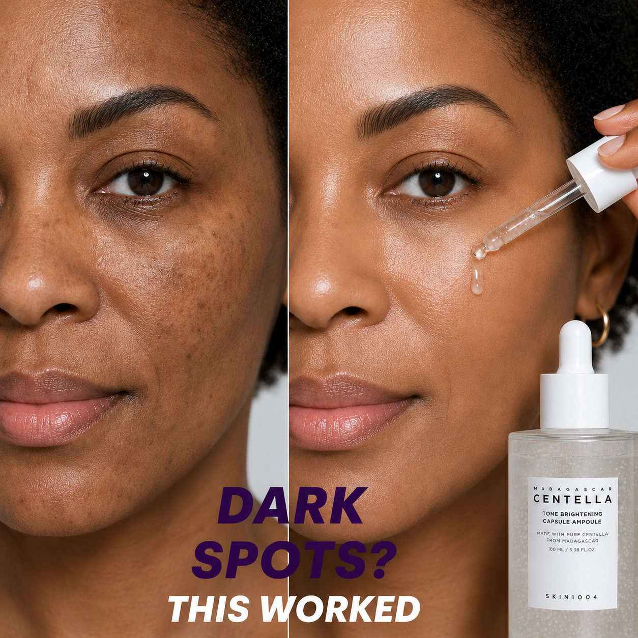 SKIN1004 Centella Ampoule Serum – Brighten & Correct Dark Spots