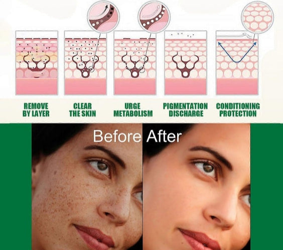 Eelhoe Dark Spot Correcting Glow Serum & Hoygi Niacinamide 10%+TXA 3% Serum